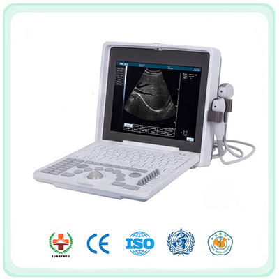 SB001 portable ultrasound scannermachine